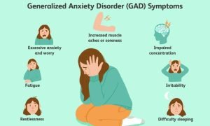 CBD for anxiety 