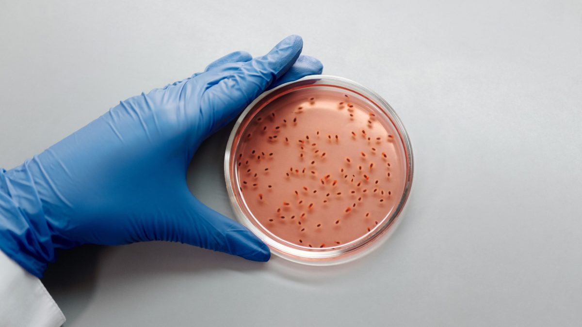 Could Cannabis Help Fight Antibiotic-Resistant MRSA?